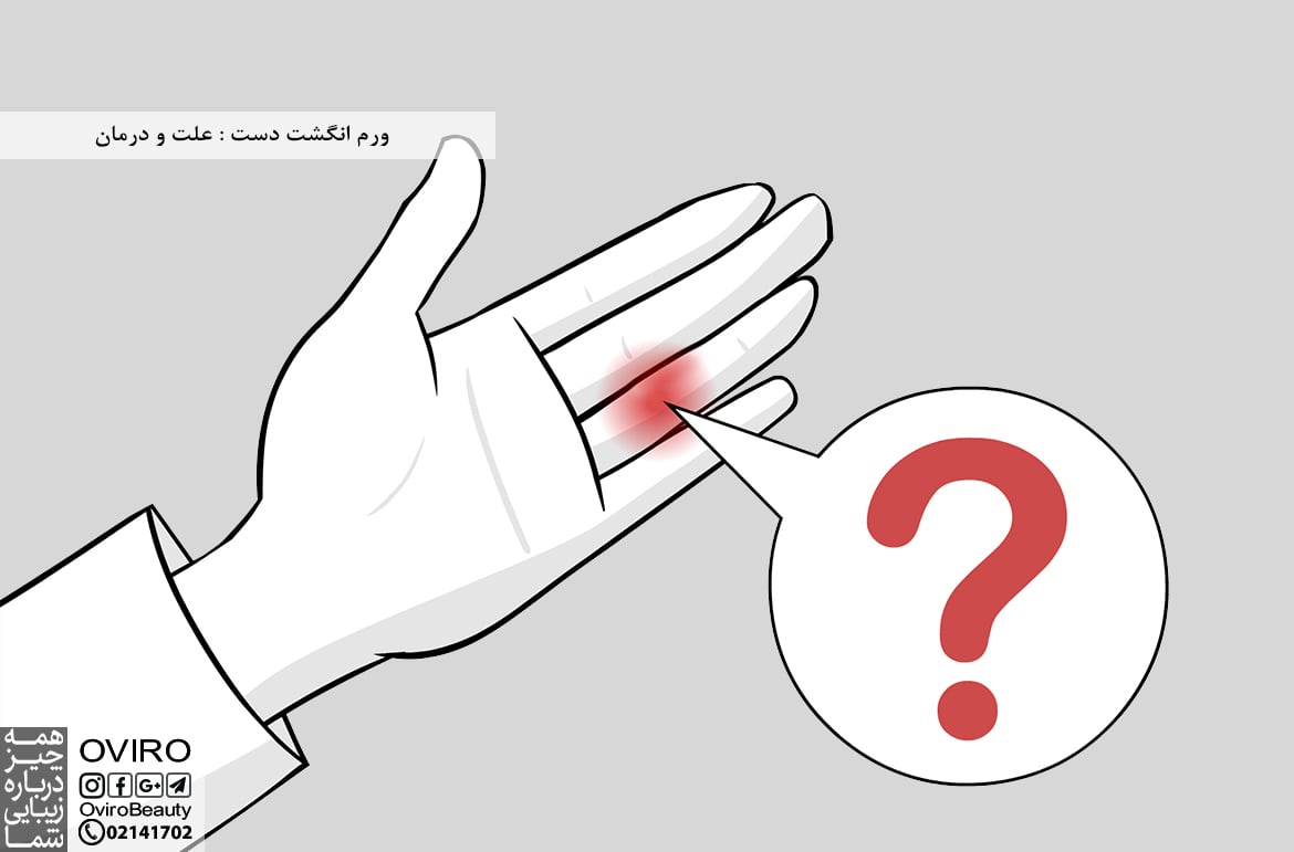 ورم انگشت دست : علت و درمان